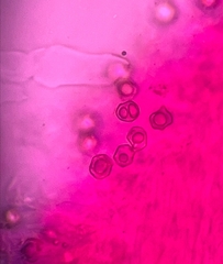 Entoloma cystomarginatum
