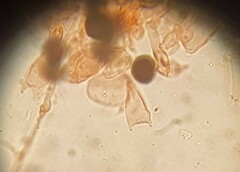 Parasola cuniculorum