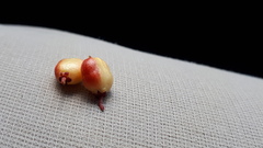 Maytenus magellanica