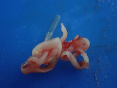 Cestoda
