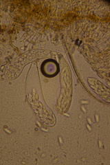 Ascozonus woolhopensis