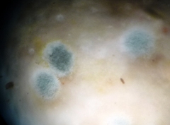 Penicillium digitatum