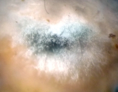 Penicillium digitatum