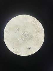 Saccharomyces cerevisiae