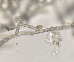 Monilinia fructicola