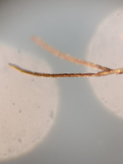 Lestremia