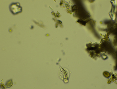 Lepadella triptera
