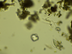 Lepadella triptera