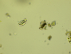 Lepadella triptera