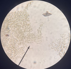 Microcystis