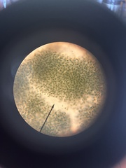 Microcystis