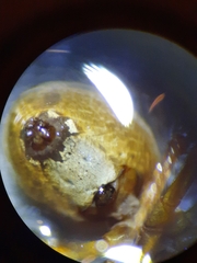 Araniella