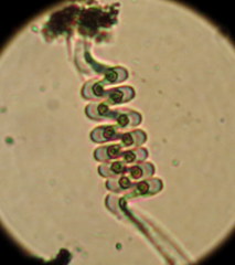 Vorticella