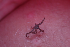 Ophiactoidea