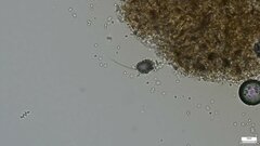 Xylariaceae