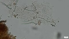 Fungi