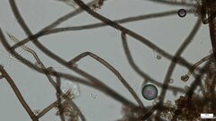 Trichaleurina tenuispora