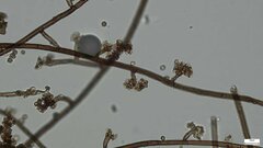 Trichaleurina tenuispora