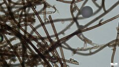Trichaleurina tenuispora