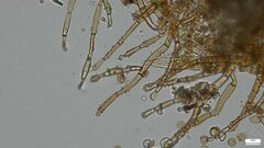 Botryobasidium