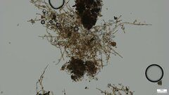 Botryobasidium