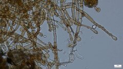Botryobasidium