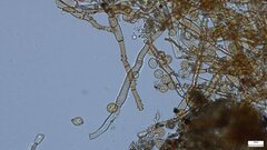 Botryobasidium