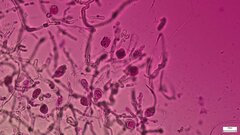 Tremella