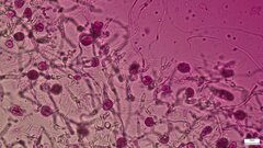 Tremella