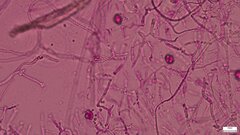 Tremella