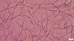 Tremella