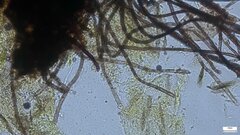 Ascomycota