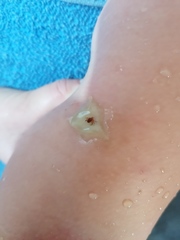 Rhipicephalus sanguineus