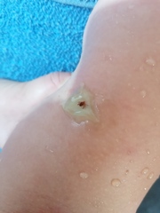 Rhipicephalus sanguineus