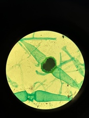 Rhizopus stolonifer