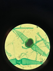 Rhizopus stolonifer
