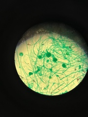 Rhizopus stolonifer