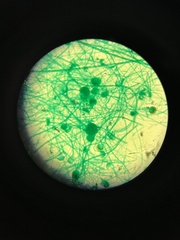 Rhizopus stolonifer