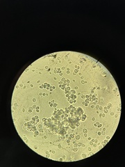Saccharomyces cerevisiae