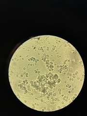Saccharomyces cerevisiae
