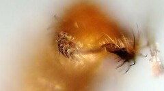 Lestremia