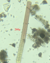 Fragilaria