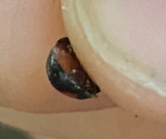 Chilocorus stigma