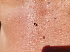 Eriopis chilensis