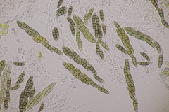 Hysterium angustatum