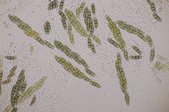 Hysterium angustatum