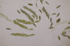 Hysterium angustatum