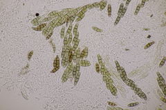 Hysterium angustatum