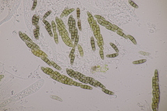 Hysterium angustatum