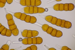 Phragmidium fragariae